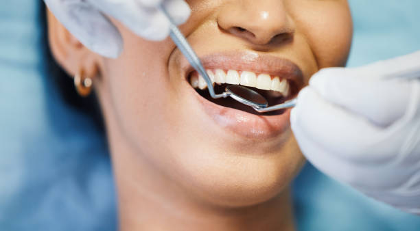 Best Emergency Treatment for Oral Infections in Baxley, GA